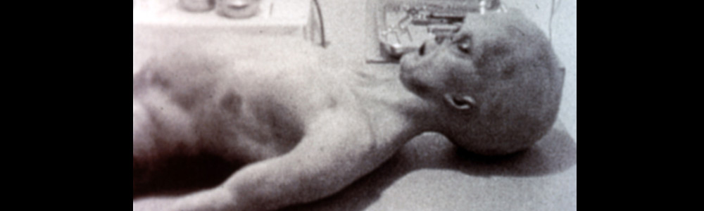 alien autopsy