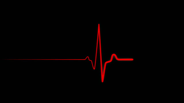 flatline